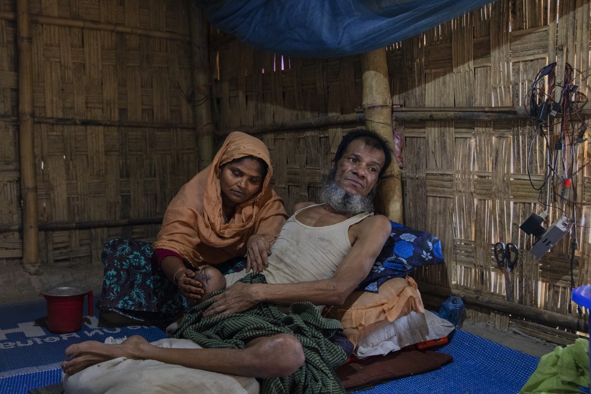 Inan Hossein, with his wife Halema Khatun, lost his leg to a gunshot from a government soldier in Myanmar.