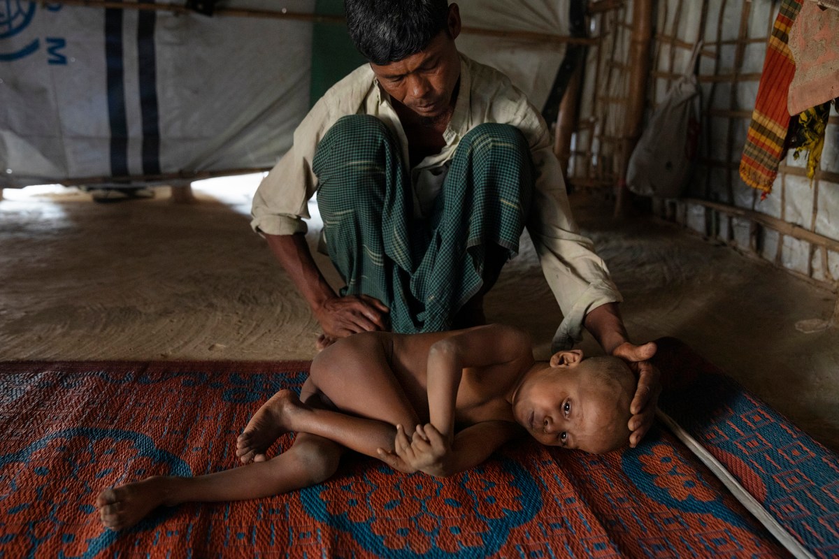 Mohammed Amin cares for his sick son, 7-year-old Mujibur Rahman, in a hut. The boy suffers from a nervous system disorder, his father said.